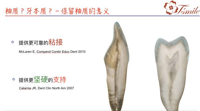 牙齿缺损修复方法有哪些_牙齿缺损修复方法视频_牙齿缺损修复方法