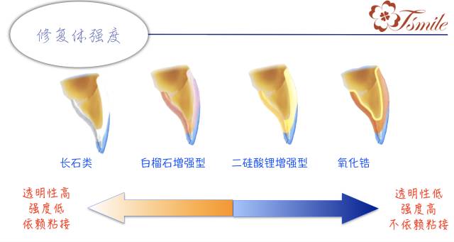 牙齿缺损修复方法_牙齿缺损修复方法视频_牙齿缺损修复方法有哪些