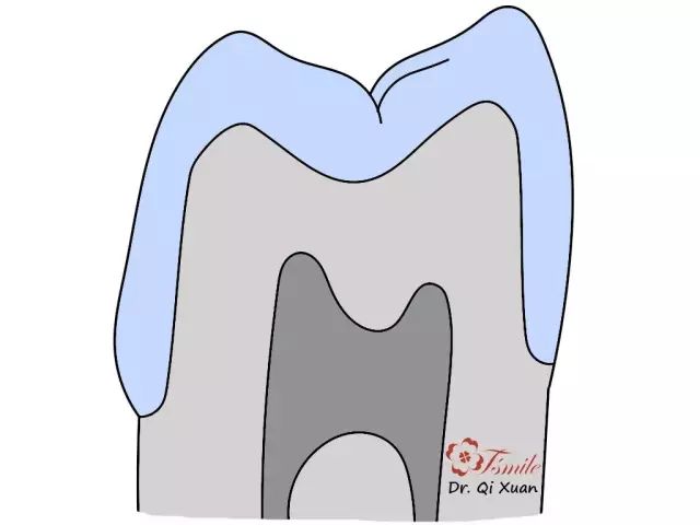 牙齿缺损修复方法视频_牙齿缺损修复方法_牙齿缺损修复方法有哪些