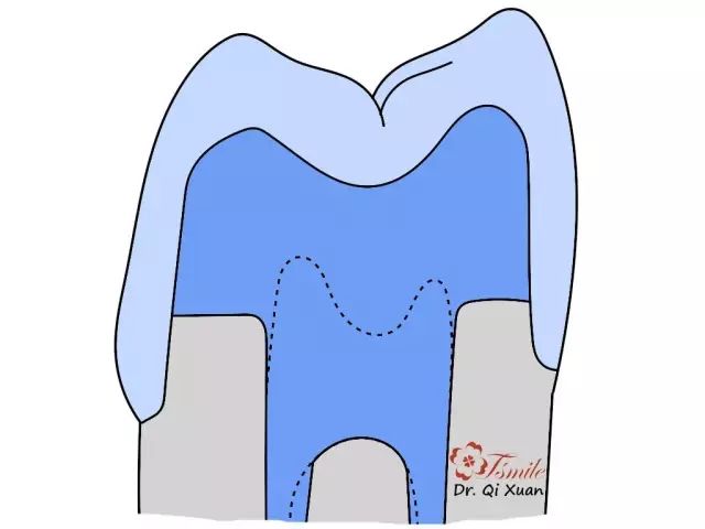 牙齿缺损修复方法_牙齿缺损修复方法有哪些_牙齿缺损修复方法视频