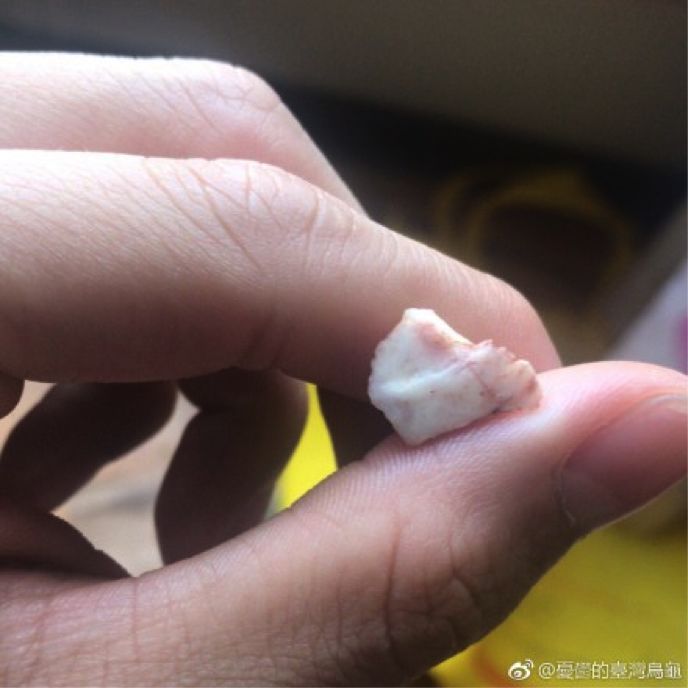 智齿冠周炎吃什么药 经验_药经验吃智齿冠周炎有用吗_智齿冠周炎吃了药怎么越来越疼