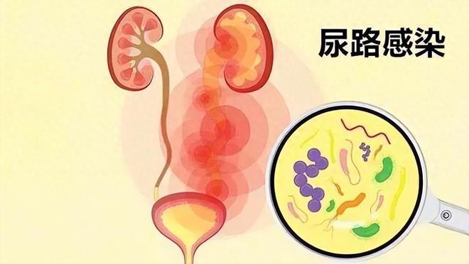 女性尿频带血_女士尿频还尿血是怎么回事_女性尿频带有血丝是怎么回事