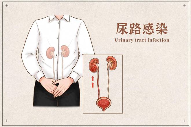 女性尿频带有血丝是怎么回事_女士尿频还尿血是怎么回事_女性尿频带血