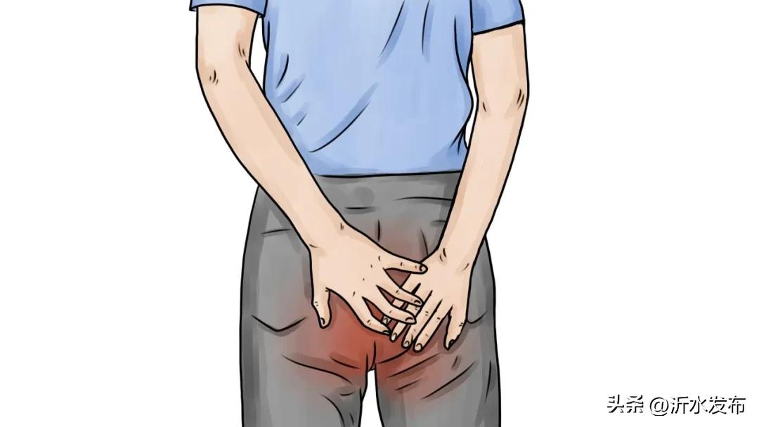 大便出血男性严重吗_大便出血男士大便出血怎么办_男性大便出血原因