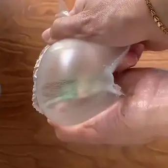 孕期几个月长妊娠纹_怀孕期间长妊娠纹_孕期长妊娠纹的地方有点疼