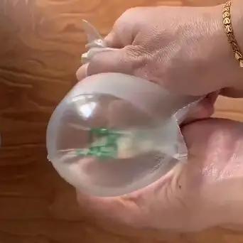 孕期几个月长妊娠纹_孕期长妊娠纹的地方有点疼_怀孕期间长妊娠纹