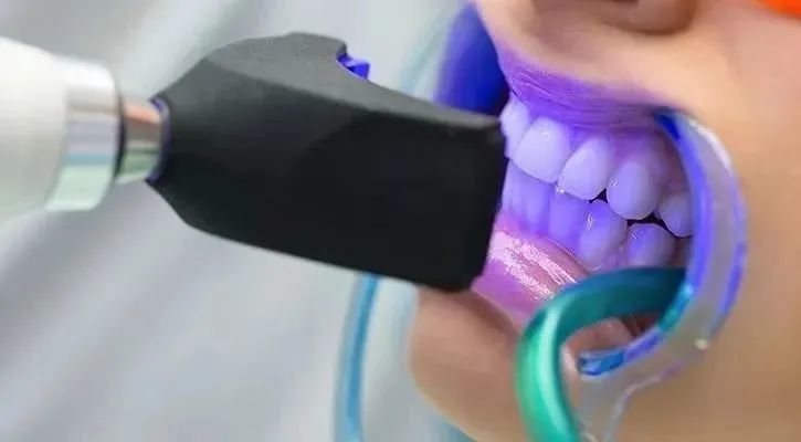 牙齿洁白的方法_洁白牙齿方法有哪些_洁白牙齿方法视频