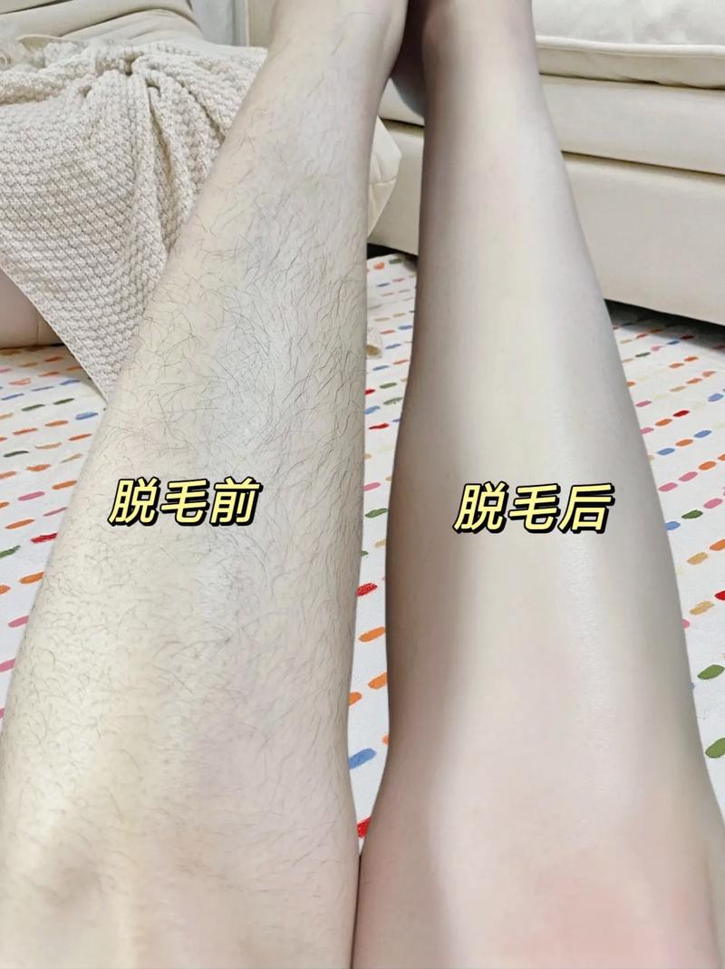 怎么样可以永久脱毛