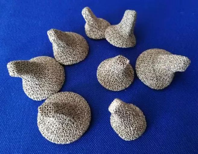 人工全髋关节翻修技术_人工髋关节翻修最新技术_人工髋关节翻修手术学