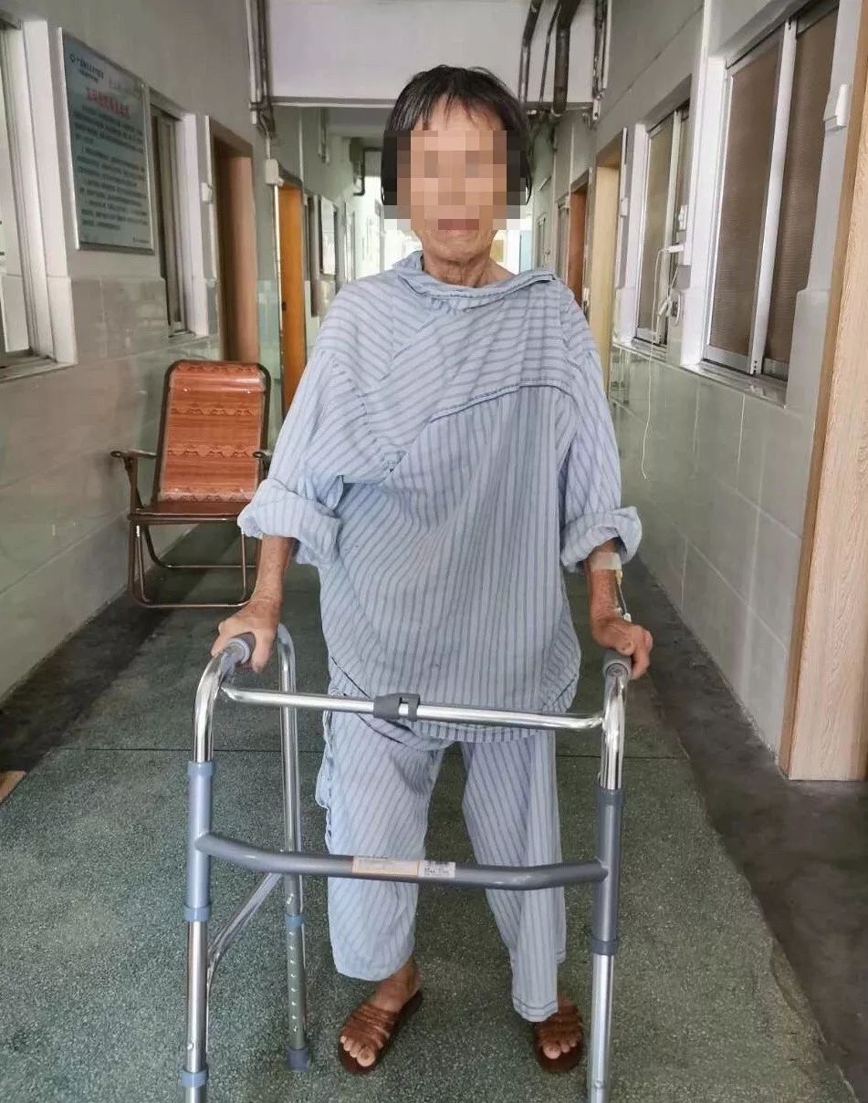 人工全髋关节翻修技术_人工髋关节翻修最新技术_人工髋关节翻修手术学