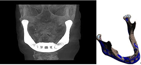 中国数字科技馆(图29) 3D打印技术原理_3d打印fdm技术_3D打印应用领域