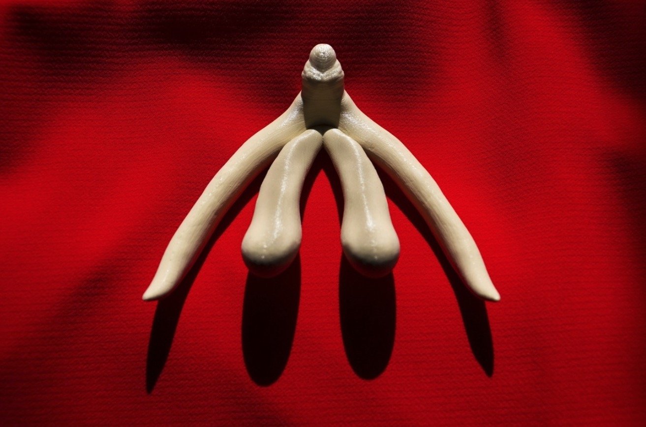 女性竟然也需要割包皮,你知道吗?(图2) 阴蒂包皮过长原因_宝宝阴蒂一面包皮过长怎么回事_阴蒂包皮手术适应症