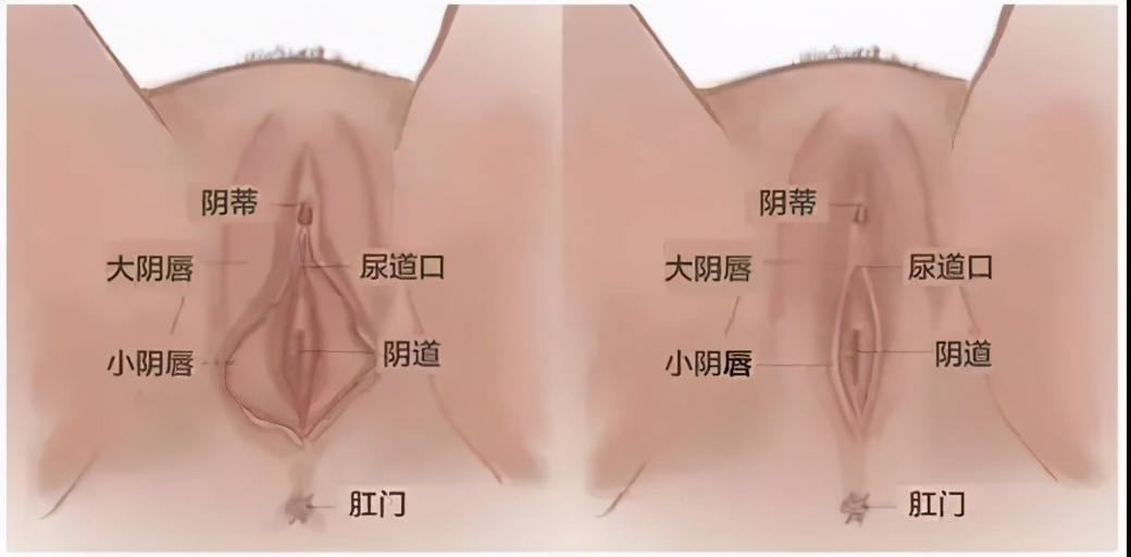 蝴蝶不对称?你会去做整形吗?(图2) 小阴唇整形手术_私密整形正规医院_宝宝阴蒂一面包皮过长怎么回事