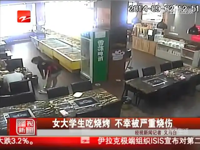 女大学生吃烧烤 不幸被严重烧伤截图