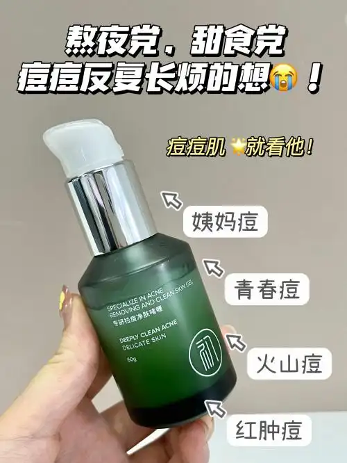 初源漾专研净痘啫喱好用吗_专业的祛痘方法_祛痘膏推荐