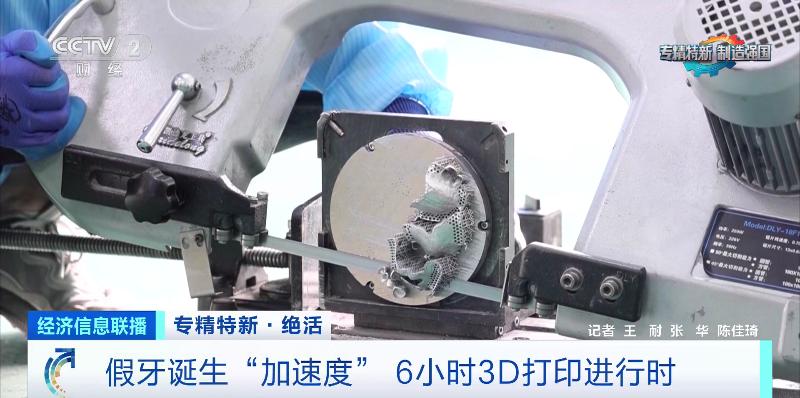 牙科烤瓷牙价钱_专精特新企业_齿科3D打印