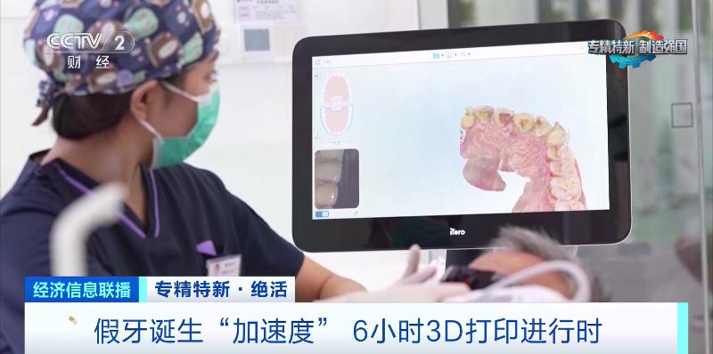 齿科3D打印_牙科烤瓷牙价钱_专精特新企业