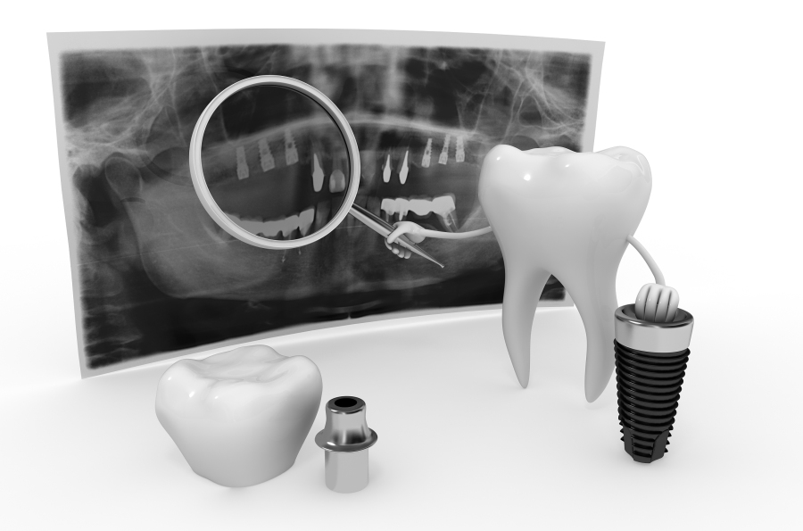 家鸿口腔招股书分析_牙科烤瓷牙价钱_种植牙费用构成