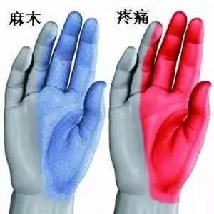 手麻、手痛,熟睡中被“麻醒”?西安医生提醒:上班族当心(图3) 13801640992090305