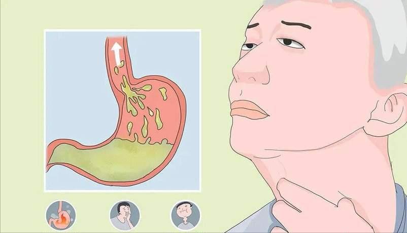 喉咙的这几个表现,别以为是感冒,或是癌症的信号,一定要注意了(图7) 嗓子反复疼痛怎么回事_喉咙异物感持续两周以上_声音嘶哑超过两周未愈